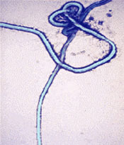 Story image