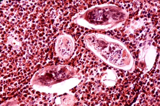 Story image
