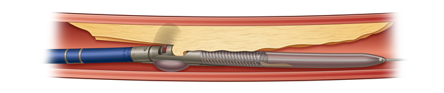 Story image